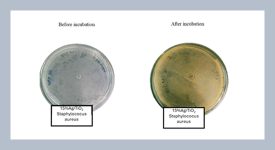 Utilization of Gynura procumbens leaf extract as a bioreductor for the synthesis of Ag/TiO2 and Ag/ZnO and its application in multifunctional lotion  