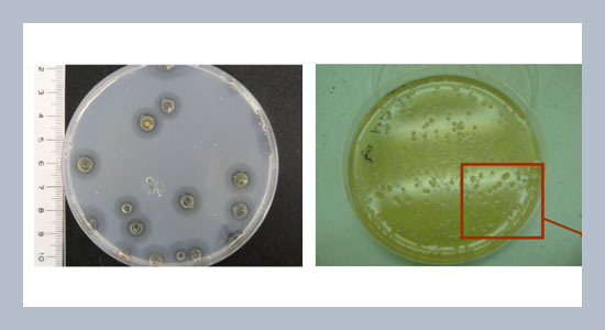 The Discoveery of Agarolytic Bacterium with Agrarse Gene Containing Plasmid, and Sone Enzymology Characteristics