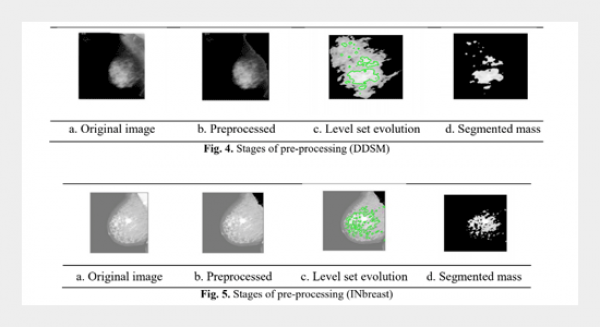 Analyses of statistical feature fusion techniques in breast cancer detection